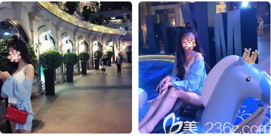 廣州中家醫(yī)家庭醫(yī)生大腿吸脂一個月術(shù)后 廣州中家醫(yī)家庭醫(yī)生大腿吸脂一個月術(shù)后