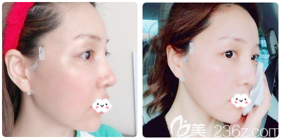 韓國(guó)優(yōu)雅斯<span style= 韓國(guó)優(yōu)雅斯<span style=