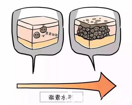 懷孕臉上長斑的原因