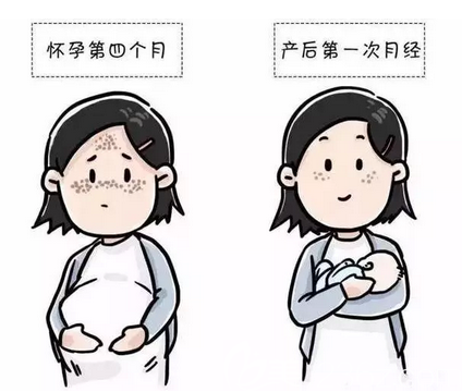 妊娠斑有的會在月經(jīng)后逐漸淡化