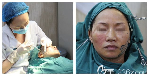 體驗熱瑪吉治療過程中