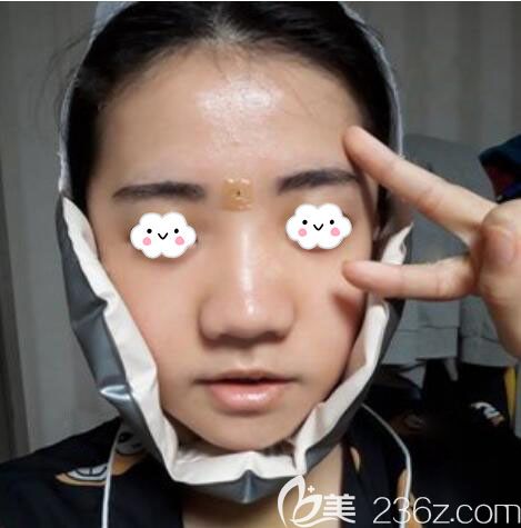 韓國(guó)EU頜面輪廓整形雙顎手術(shù)矯正突嘴 韓國(guó)EU頜面輪廓整形雙顎手術(shù)矯正突嘴