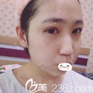 在張家口天宏做眼綜合術(shù)后7天進(jìn)行拆線