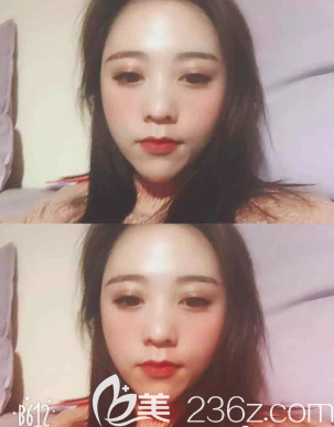 一個(gè)禮拜后的樣子 一個(gè)禮拜后的樣子