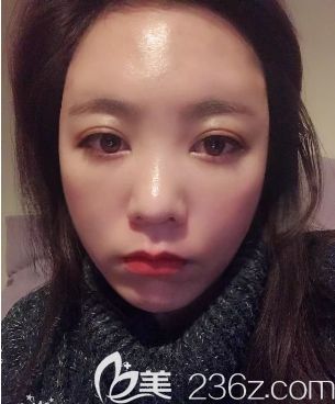 羅<!--<i data=20240703-sp></i>-->主任給我手術(shù)第二天 羅<!--<i data=20240703-sp></i>-->主任給我手術(shù)第二天