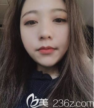 羅<!--<i data=20240703-sp></i>-->做脂肪填充好嗎 羅<!--<i data=20240703-sp></i>-->做脂肪填充好嗎