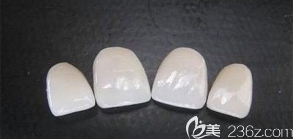 瓷貼面后需要注意的事項 瓷貼面后需要注意的事項