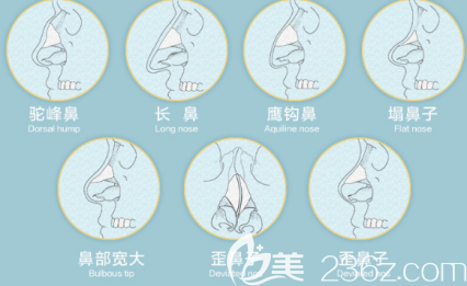 不理想的鼻子類型