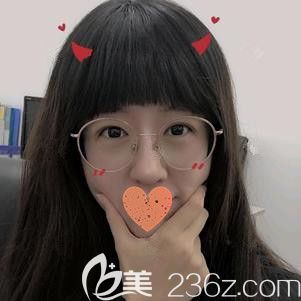 前段時(shí)間我在鄭州華領(lǐng)做全切雙眼皮+開內(nèi)眼角手術(shù) 現(xiàn)在恢復(fù)28天就由三角瞇瞇眼瞬變嫵媚大電眼