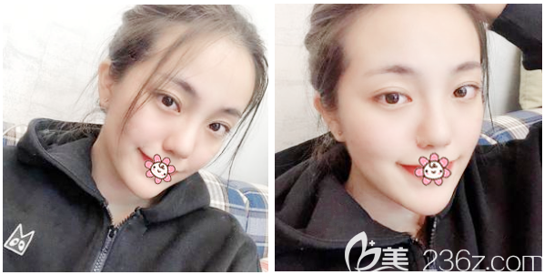 來(lái)看<!--<i data=20240703-sp></i>-->整形醫(yī)院割雙眼皮怎么樣 來(lái)看<!--<i data=20240703-sp></i>-->整形醫(yī)院割雙眼皮怎么樣