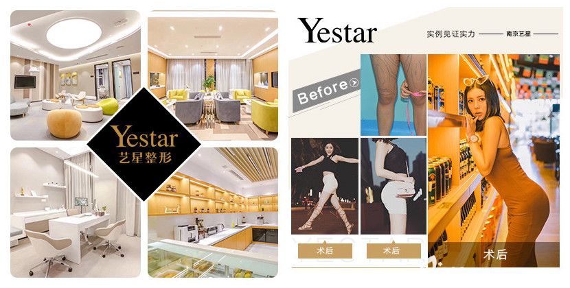 南京藝星環(huán)境和吸脂案例