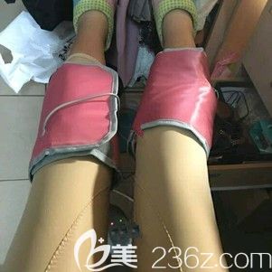 剛做完大腿環(huán)吸術(shù)后消腫恢復(fù)階段