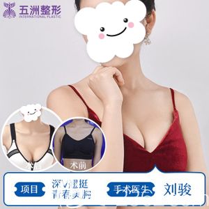 劉俊院長做深V動感豐胸術(shù)后胸部挺拔豐滿