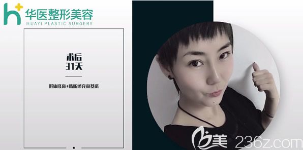 看過呼和浩特整形醫(yī)院排名榜后 我找呼市華醫(yī)宋耀宗醫(yī)生做了假體隆鼻+脂肪填充鼻基底