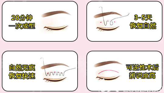 內江達芬奇納米無痕雙眼皮優(yōu)勢