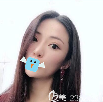 20190703_1562125890371740.png image.png