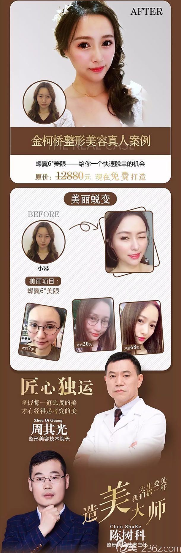 金柯橋整形蝶翼六度美眼案例效果