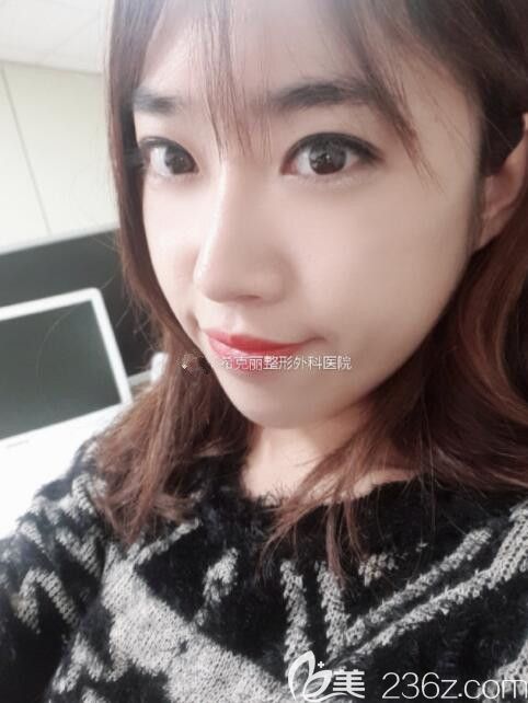 腫泡眼在韓國(guó)?？他愙w鏞瑾做了雙眼皮眼底脂肪排列很滿意不后悔