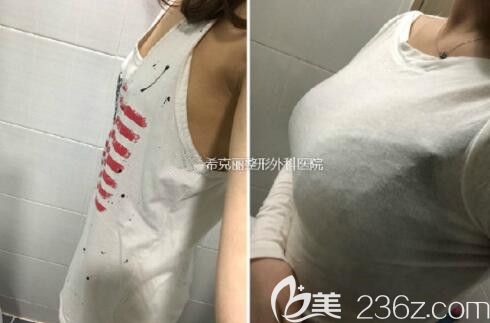 ??？他怱ECRET整形外科趙鏞瑾的一大波隆胸案例看的我都流鼻血了