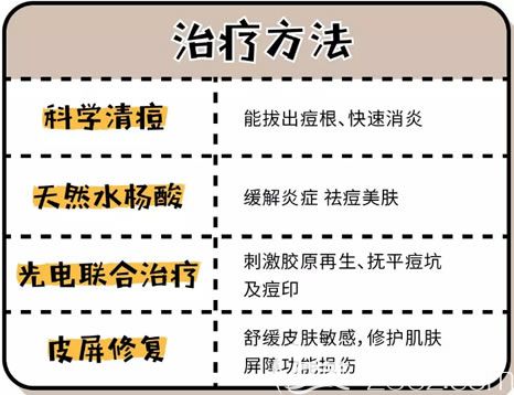 寧波薇琳多維祛痘步驟