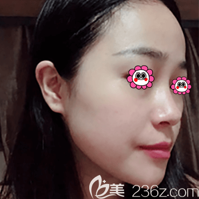 北京皮秒祛斑哪里好？北京紫潔醫(yī)美超皮秒祛斑美膚效果參考