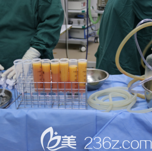 于曉春醫(yī)生給我做自體脂肪豐胸手術(shù)當(dāng)天照 于曉春醫(yī)生給我做自體脂肪豐胸手術(shù)當(dāng)天照