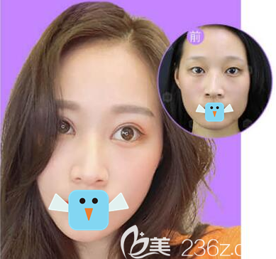 成都成美王立鵬眼綜合效果圖