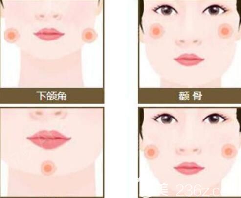 面部吸脂分幾個部位