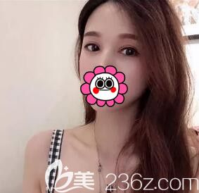 懷化華美醫(yī)療美容醫(yī)院好嗎？看了我找周光杰割雙眼皮三個(gè)月后恢復(fù)效果圖就知道了！
