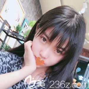 <!--<i data=20240703-sp></i>-->東醫(yī)生為我注射瘦臉一周有瘦臉效果