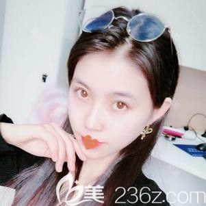 天宏<!--<i data=20240703-sp></i>-->東醫(yī)生注射瘦臉術后12天瘦臉效果明顯