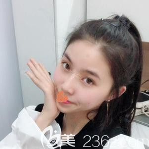  肉肉大餅?zāi)樀奈乙恢毕霌碛芯滦臉 來到張家口天宏找東醫(yī)生注射一支瘦臉就能輕松搞定