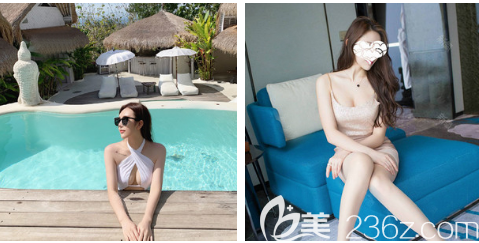 自體脂肪隆胸術(shù)后兩個(gè)月恢復(fù)過(guò)程圖片 自體脂肪隆胸術(shù)后兩個(gè)月恢復(fù)過(guò)程圖片