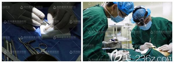 陳勇醫(yī)生做肋軟骨隆鼻手術(shù)中 陳勇醫(yī)生做肋軟骨隆鼻手術(shù)中