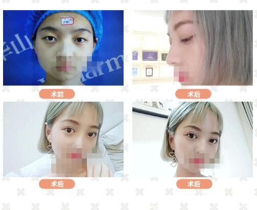 靈動小鹿眼綜合