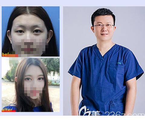 M.star綜合升級版