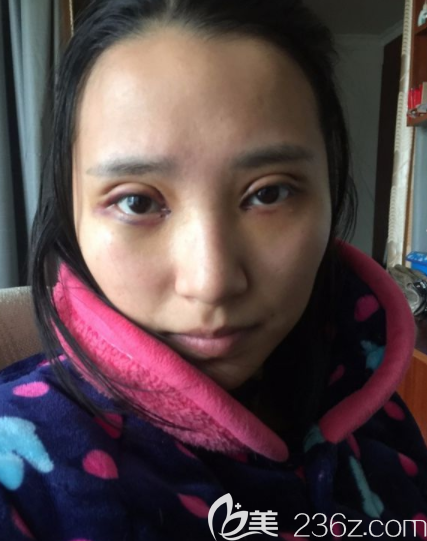 20190711_1562827167745636.png image.png