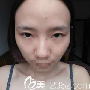 四天效果很明顯