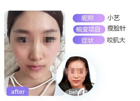 效果怎么樣 眼見為實