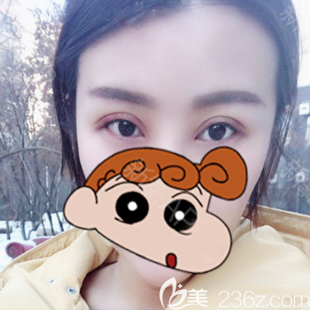 深圳鵬程醫(yī)院做雙眼皮怎么樣 深圳鵬程醫(yī)院做雙眼皮怎么樣