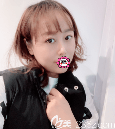 北京惠合嘉美眼綜合案例 北京惠合嘉美眼綜合案例