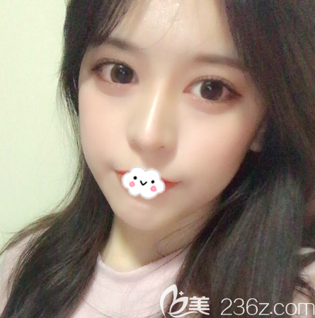 去韓國原辰整形醫(yī)院找樸原辰做完雙眼皮隆鼻和脂肪填充后拿到一份整形價(jià)格表