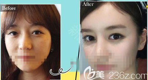 醫(yī)院真人案例對比圖片