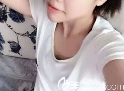 我在南寧華美整形做吸脂和豐胸手術(shù)前照片 我在南寧華美整形做吸脂和豐胸手術(shù)前照片