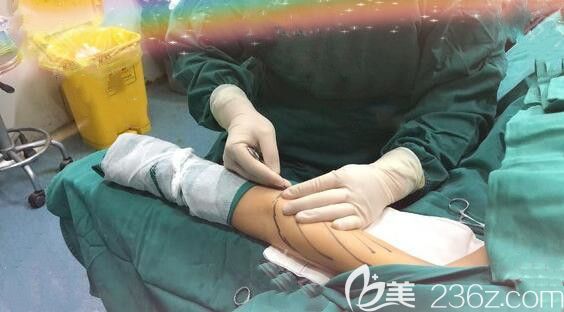 在合肥藝星整形做吸脂瘦手臂術(shù)前打麻藥 在合肥藝星整形做吸脂瘦手臂術(shù)前打麻藥