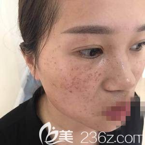 到醫(yī)院以后就先面診 到醫(yī)院以后就先面診