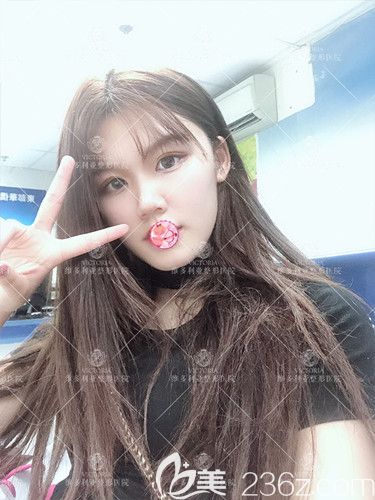 維多利亞醫(yī)生孫凱為我做眼綜合術(shù)后15天已經(jīng)消腫