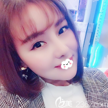 看了東莞隆鼻醫(yī)院排名后我找東莞壹加壹王擎做了肋軟骨隆鼻,給大家分享下術(shù)后恢復(fù)全過(guò)程