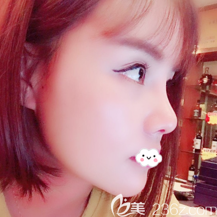 東莞壹加壹整形美容醫(yī)院做隆鼻效果怎么樣