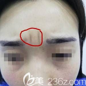 額頭上已經(jīng)有了深深的川字紋 額頭上已經(jīng)有了深深的川字紋